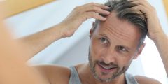 ما حكم زراعة الشعر